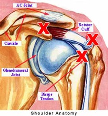 Shoulder joint tendons