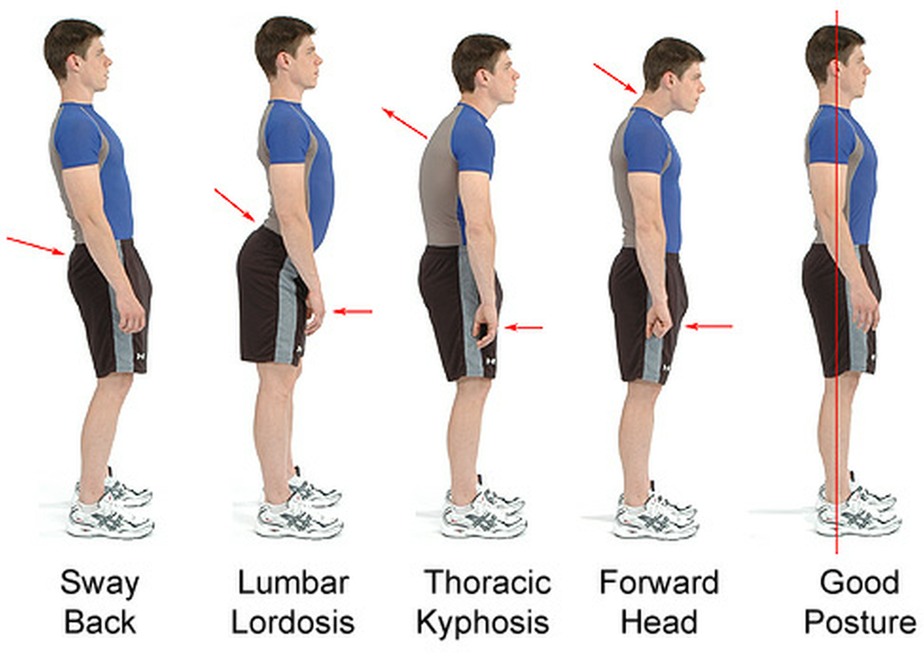 Standing Posture variations